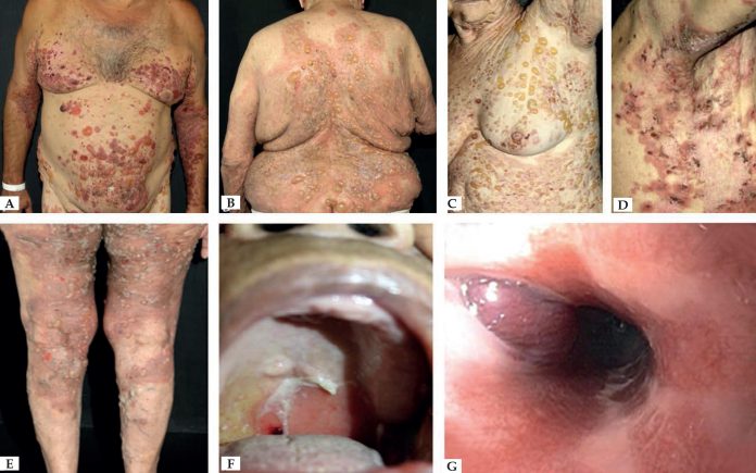 0586017a42c33496d11bc344bd61b2453f9e383e