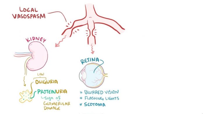 3850378299001 5529068815001 5529046313001 vs