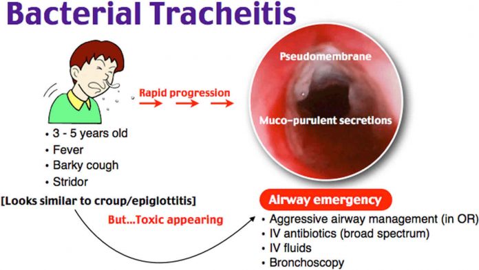 Tracheitis