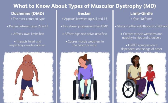 muscular dystrophy types 5180145 final 2c536062cacd49e8a3ee1261e4a057d3