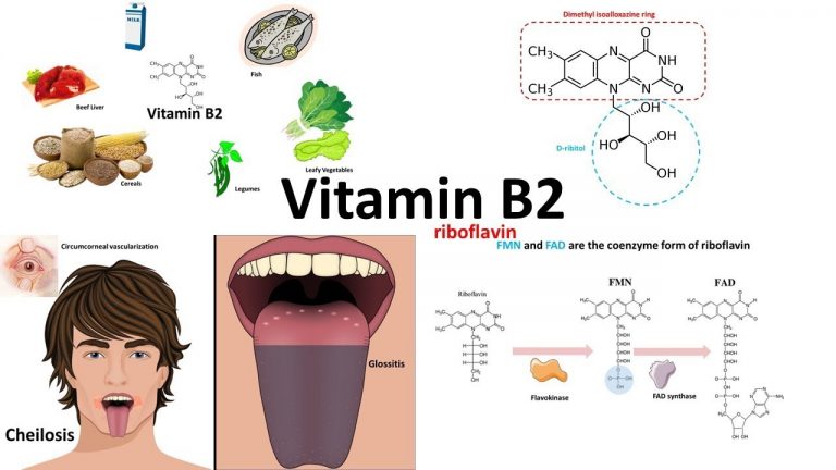 Ανεπάρκεια βιταμίνης B2 (Ριβοφλαβίνης)