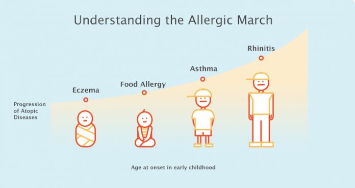 Cowsmilkallergy 1562786468295 HR