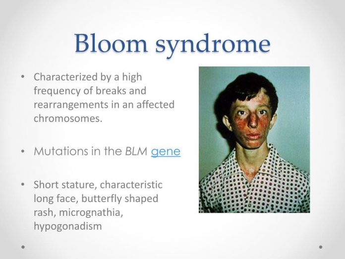 bloom syndrome l