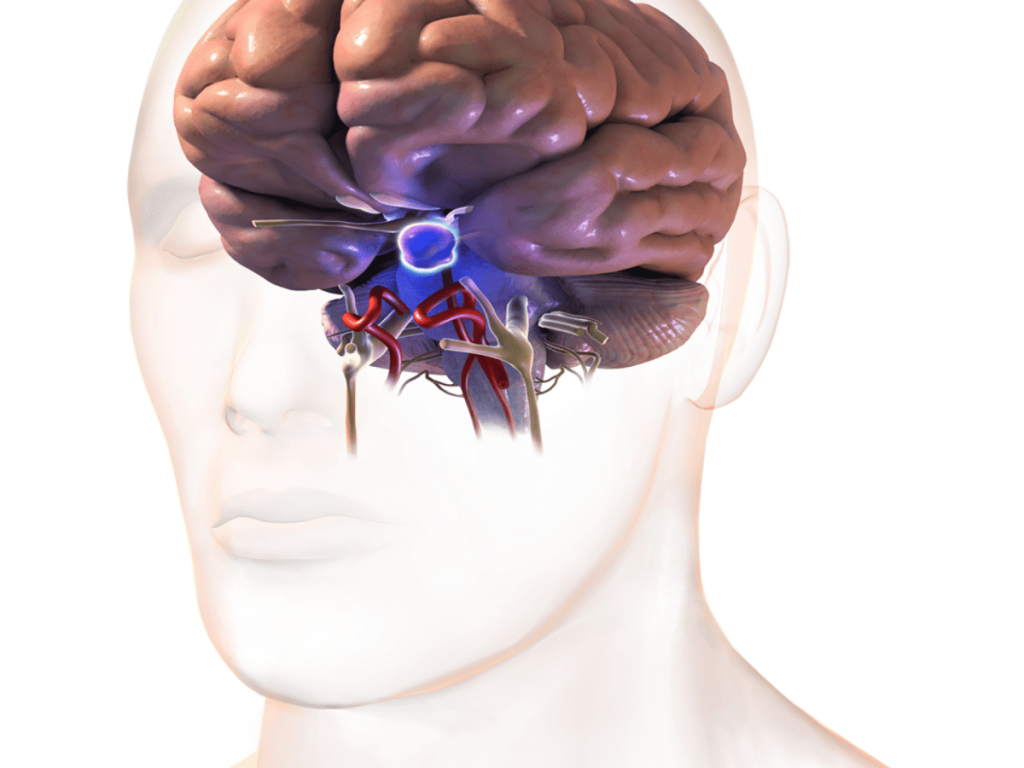 pituitary tumor prolactinoma early signs