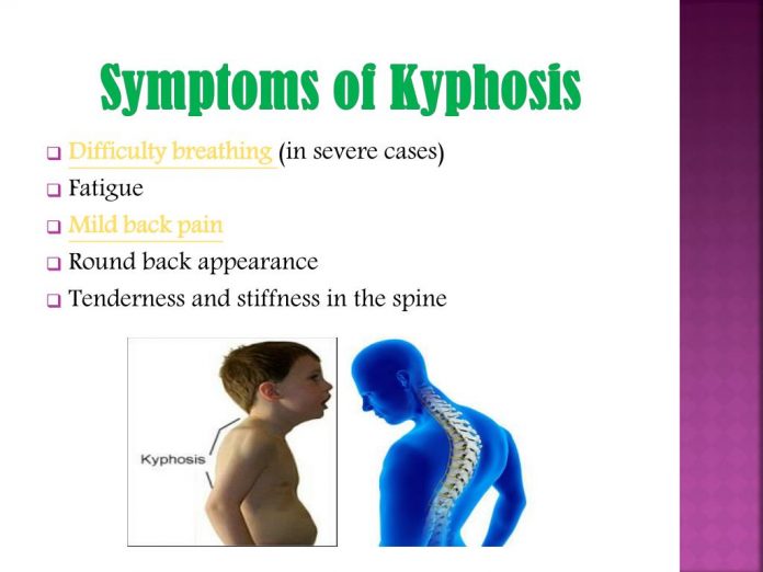 symptoms of kyphosis l