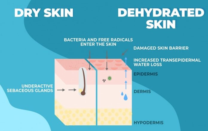 dry skin vs dehydrated characteristics 2