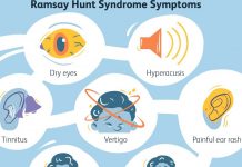 ramsay hunt syndrome overview 4174965 final 35a10caeb780457fa74ea4daec477a68