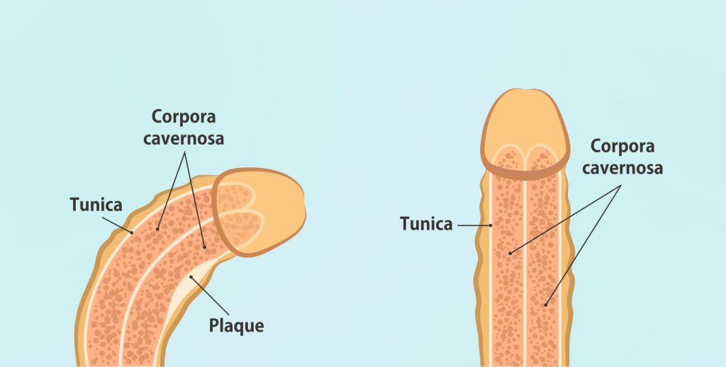 Αυτή η εικόνα δεν έχει ιδιότητα alt. Το όνομα του αρχείου είναι 5-1024x518.jpg